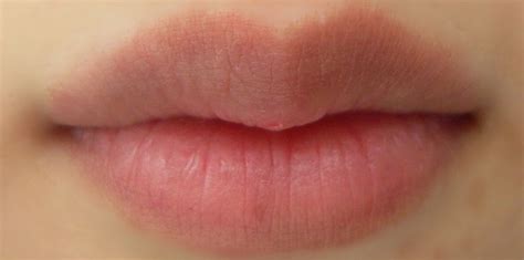 Lip Discoloration Lips Health And Beauty Melanin