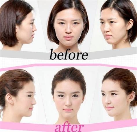 Korean Women Plastic Surgery Funnymadworld