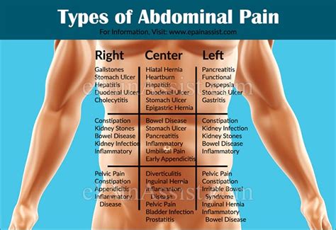 Types Of Abdominal Pain Or Stomach Ache Based On Organ Systems