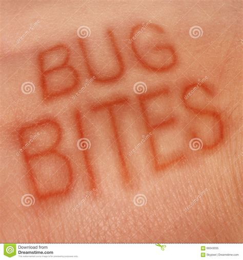 Mite Bites A Person S Body Warning Sign Royalty Free Stock Photography