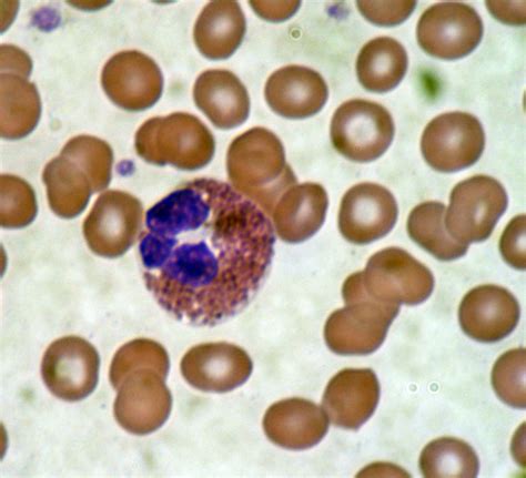ما معنى Leucocytes كلمه Leucocytes في تحليل البول شوق وغزل
