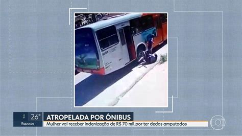 Mulher é Indenizada Após Perder Os Dedos Do Pé Ao Ser Atropelada Por