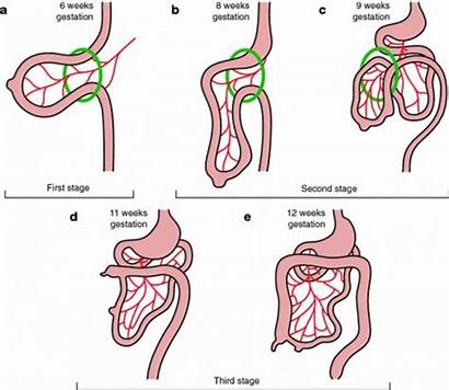 Rotation Intestinal Normal Cartoon Intestine Development Gastrointestinal