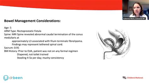 Anorectal Malformations Pediatric Surgery Series Lecture 3 By Dr