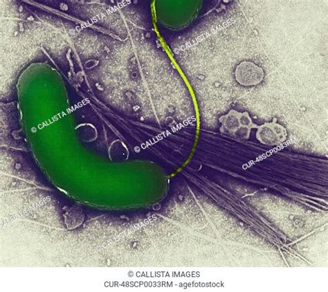 Scanning Electron Micrograph Of Vibrio Cholerae Bacteria Stock Photos