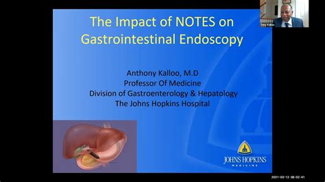 The Impact Of Notes On Gastrointestinal Endoscopy Youtube
