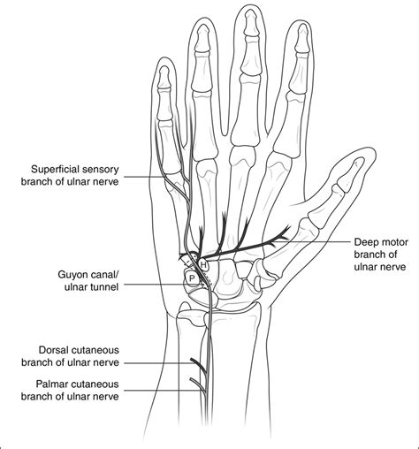 Ulnar Nerve Entrapment At The Wrist JAAOS Journal Of The American Academy Of Orthopaedic