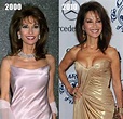 Susan Lucci Plastic Surgery Before and After | | Plastic Surgery Magazine