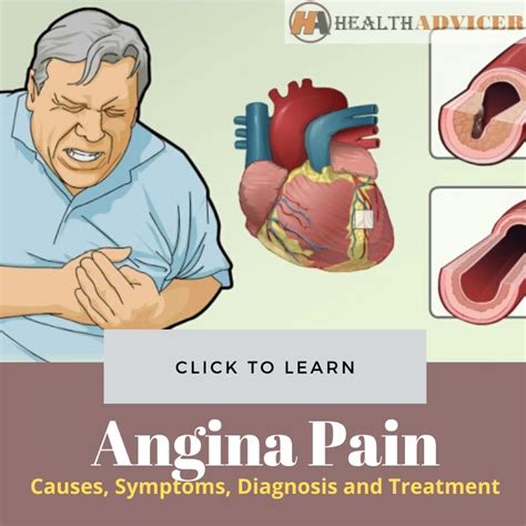 Angina Pain Causes Symptoms Diagnosis And Treatment