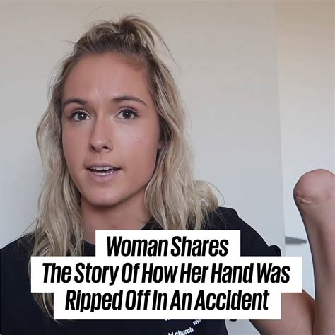Woman Shares The Story Of How Her Hand Was Ripped Off In An Accident Kristie Feared She Was