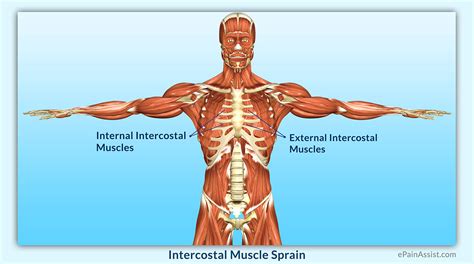 The costocorporeal joint is where the rib head connects with two adjacent vertebral bodies and the disc between them. Pulled Muscle Under Rib Cage Hurts To Breathe - Healthy Herbal