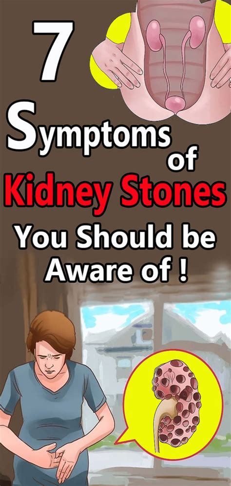 7 Symptoms Of Kidney Stones You Should Be Aware Of Healthy Lifestyle