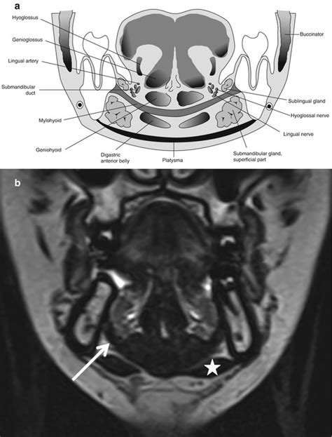 Oral Cavity And Oropharynx Radiology Key