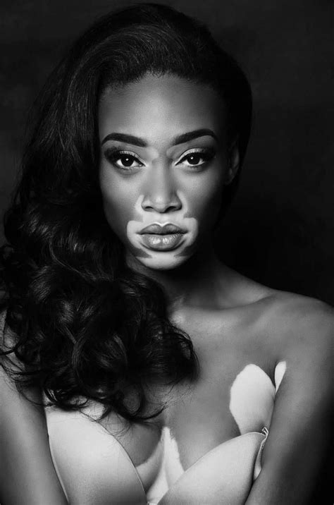 winnie harlow