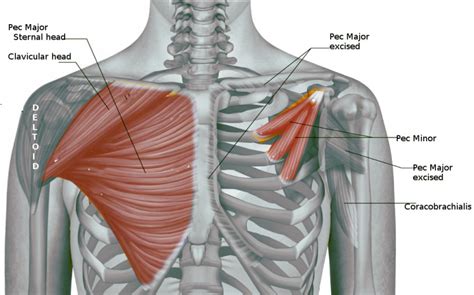Figure Pectoralis Muscles Image Courtesy Dr Chaigasame Statpearls