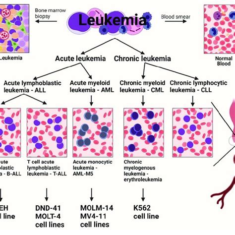The Different Types Of Human Leukemia Cell Lines Created With