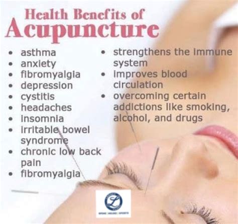 what is acupuncture benefits legacy clinic chiropractic