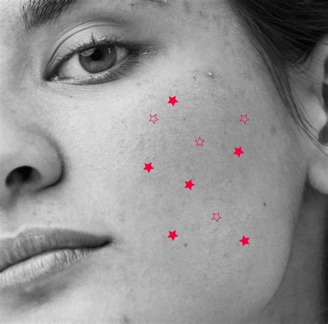 How To Hide Pitted Acne Scars With Makeup