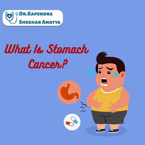 What Is Stomach Cancer Dr Kapendra Shekhar Amatya