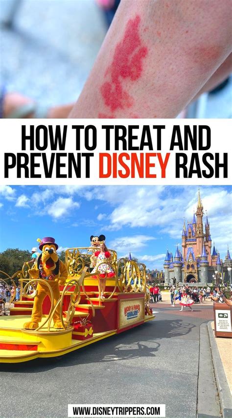How To Treat And Prevent Disney Rash Travel Bucket List Usa Usa Travel