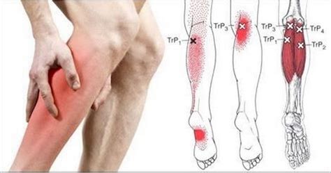 Diply Restless Leg Remedies Restless Leg Syndrome Restless Legs