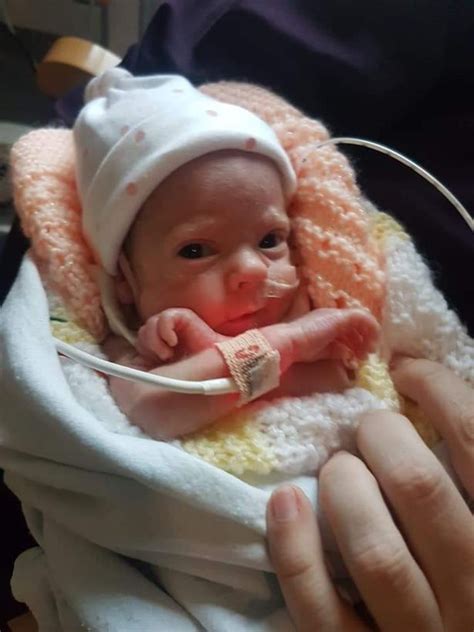 My Baby Died 12 Times North Staffordshire Mum Gives Birth To 1lb