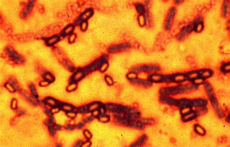 Second Probe Finds More Safety Lapses At Cdc Anthrax Labs The