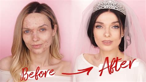 Meghan Markle Wedding Makeup Tutorial Acne Coverage Mypaleskin Now And Eternity