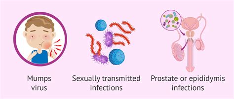 Testicular Mumps