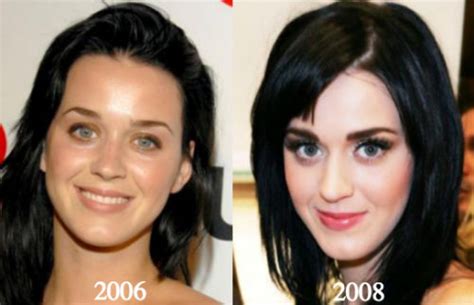 Katy Perry Plastic Surgery Before And After Photos