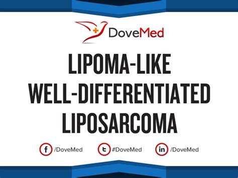 Lipoma Like Well Differentiated Liposarcoma