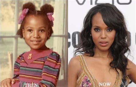 Kerry Washington Plastic Surgery Photo Before And After Celeb Surgerycom