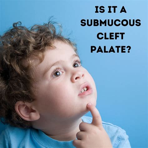 Does My Child Have A Submucous Cleft Palate Verboso