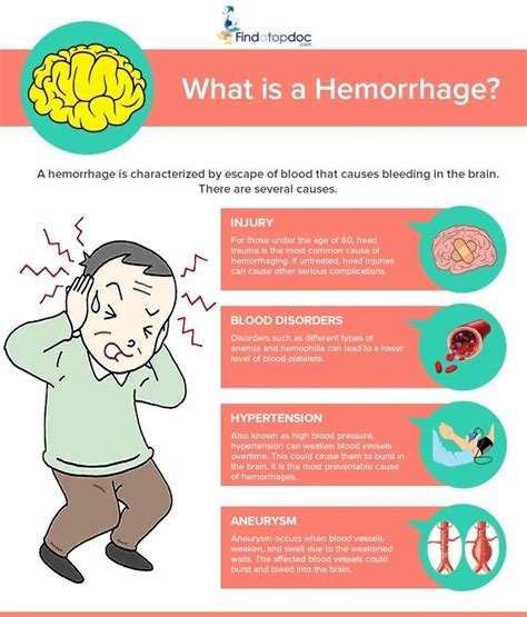 Intracranial Hemorrhage Symptoms Causes Treatment And Diagnosis