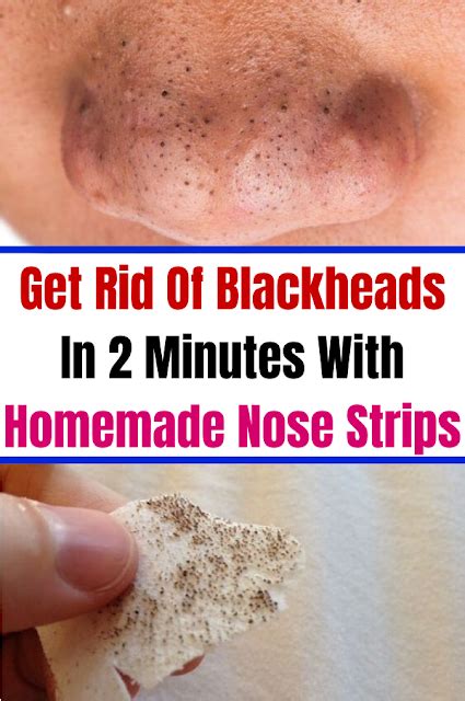 get rid of blackheads in 2 minutes with homemade nose strips passionofswathi