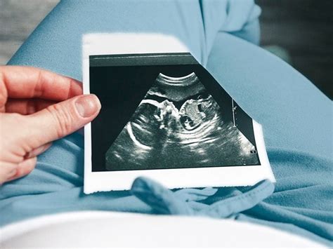 What Does Spotting Look Like During Early Pregnancy