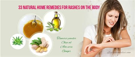 Do You Want To Know Natural Home Remedies For Rashes On The Body This Is What You Need To Know