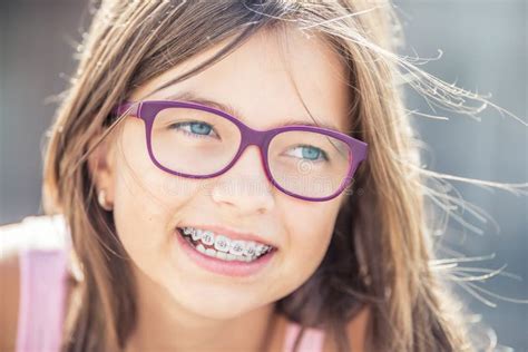 Happy Smiling Girl With Dental Braces And Glasses Young Cute Caucasian