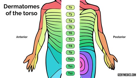 Dermatomes And Myotomes Upper Lower Limb How To Relief Dermatome Map