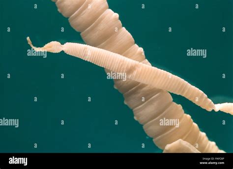 Tapeworm High Resolution Stock Photography And Images Alamy