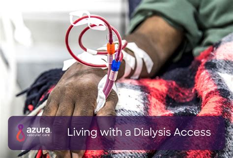 Living With A Dialysis Access Azura Vascular Care