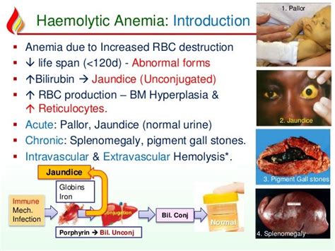 Haem13 Hemolytic Anemia Acquired