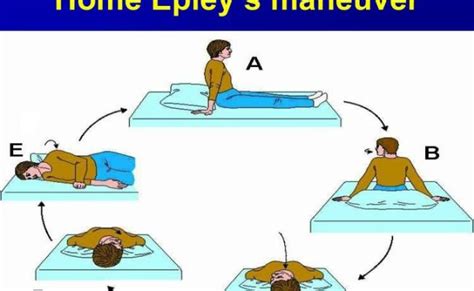 Epley Maneuver At Home Epley Maneuver Instructions How To Do The Epley