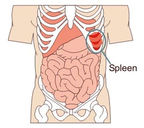 It started a few days ago and i assumed i pulled a muscle but it keeps getting worse. Spleen Pain - Location, Symptoms, Causes, Treatment