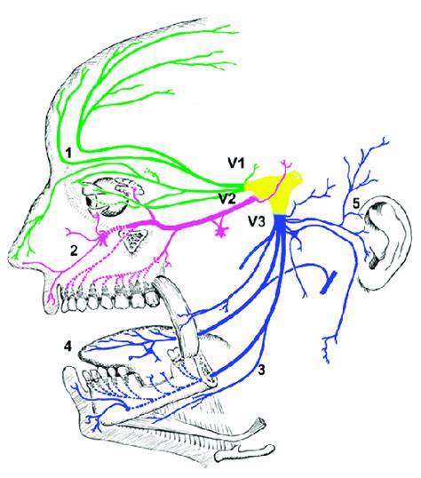 Trigeminal Nerve Branches Shown In Three Different Colors