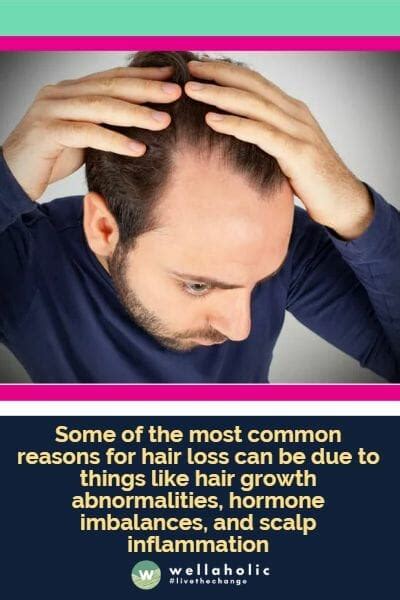Hair Loss On One Side Of The Head How To Treat