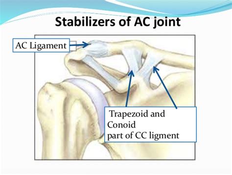 Shoulder And Elbow Surgery Chronic Ac Joint Separation