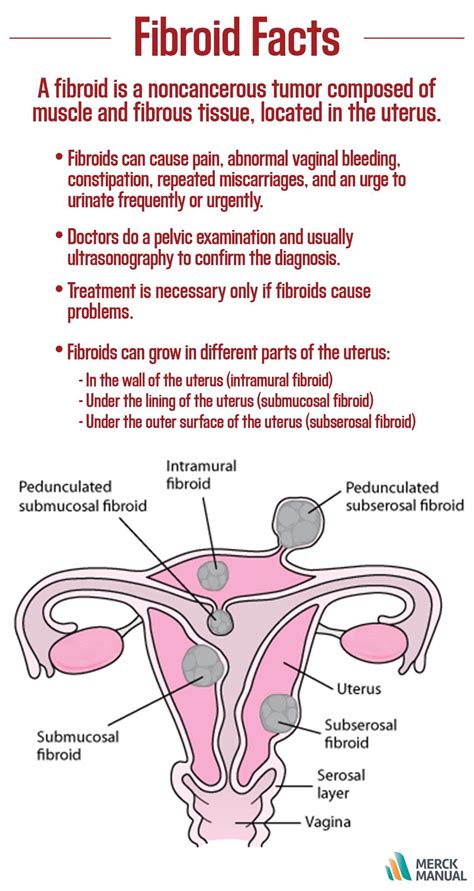 Most fibroids range from about the size of a large marble to slightly smaller than a baseball 2). By age 45, about 7 out of 10 women develop fibroids of the ...