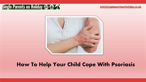 Ppt How To Help Your Child Cope With Psoriasis Powerpoint