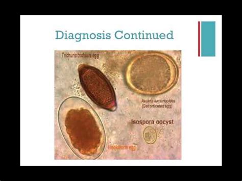 Coccidiosis is a parasitic type of infection, caused by the coccidia parasite. Coccidia in a Shelter Setting - Complete Presentation ...